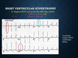 Basics of ecg | PPTX