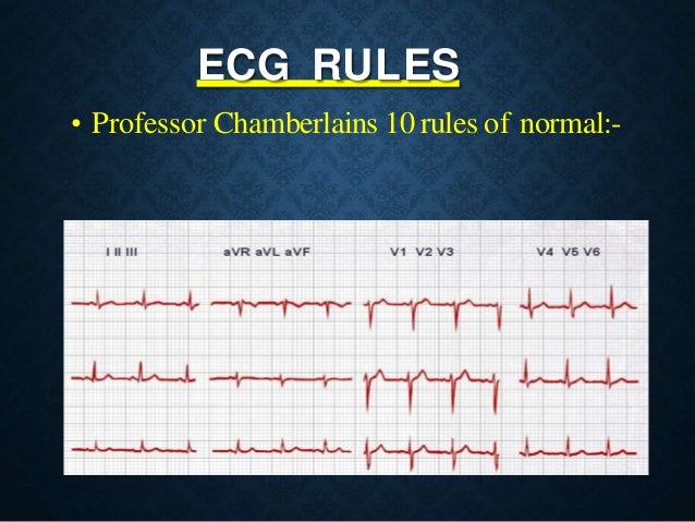 Basics Of Ecg