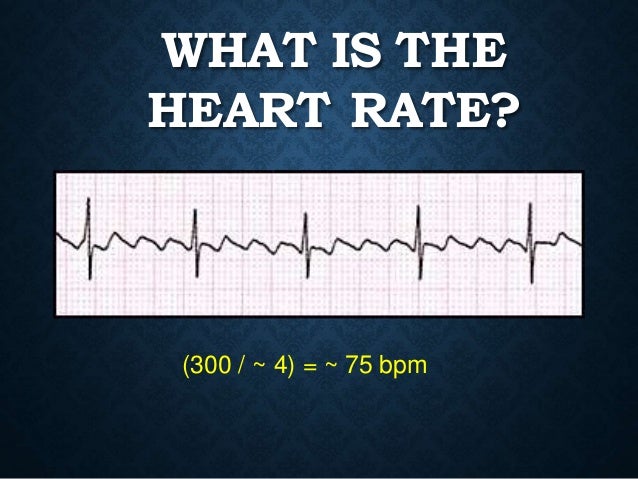 Basics Of Ecg