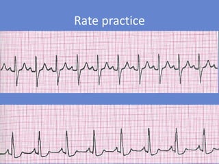 Rad Ecg Example Basics of ecg | PDF