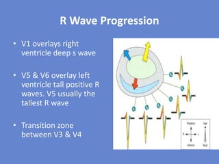 Vt R Wave Basics of ecg | PDF