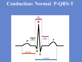 Basics of ecg | PDF