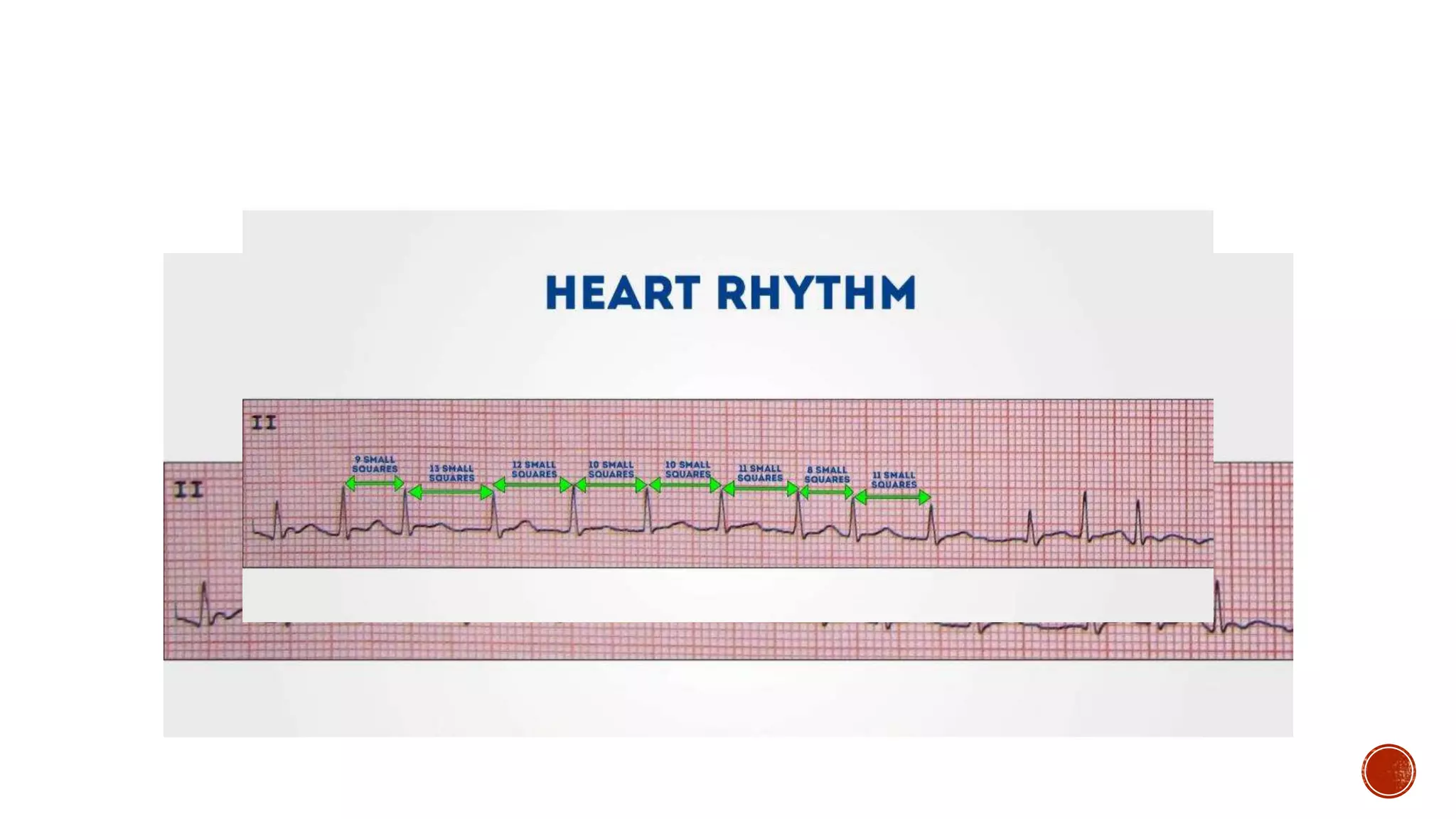 Basics of ECG.pptx