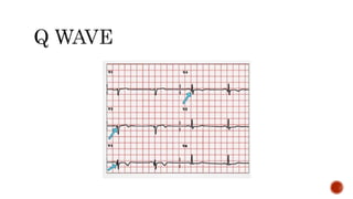 Basics of ECG.pptx