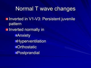 Basics of ECG.ppt