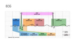 ECG
 