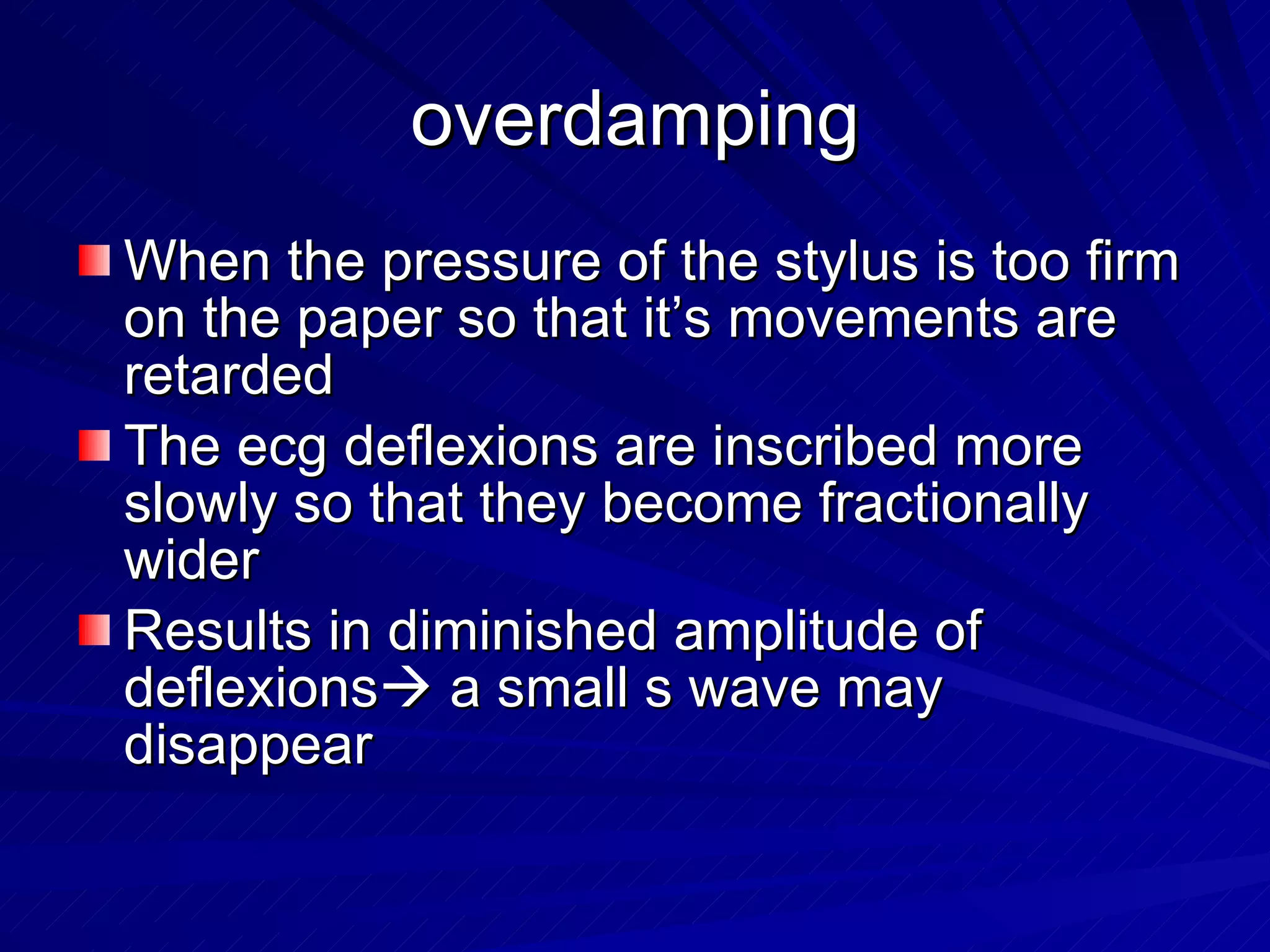 overdamping When the pressure of the stylus is too firm on the paper so that it’s movements are retarded The ecg deflexions are inscribed more slowly so that they become fractionally wider Results in diminished amplitude of deflexions   a small s wave may disappear 