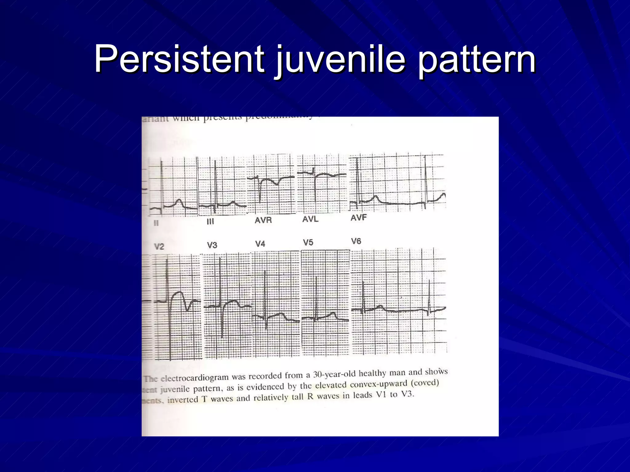 Persistent juvenile pattern 