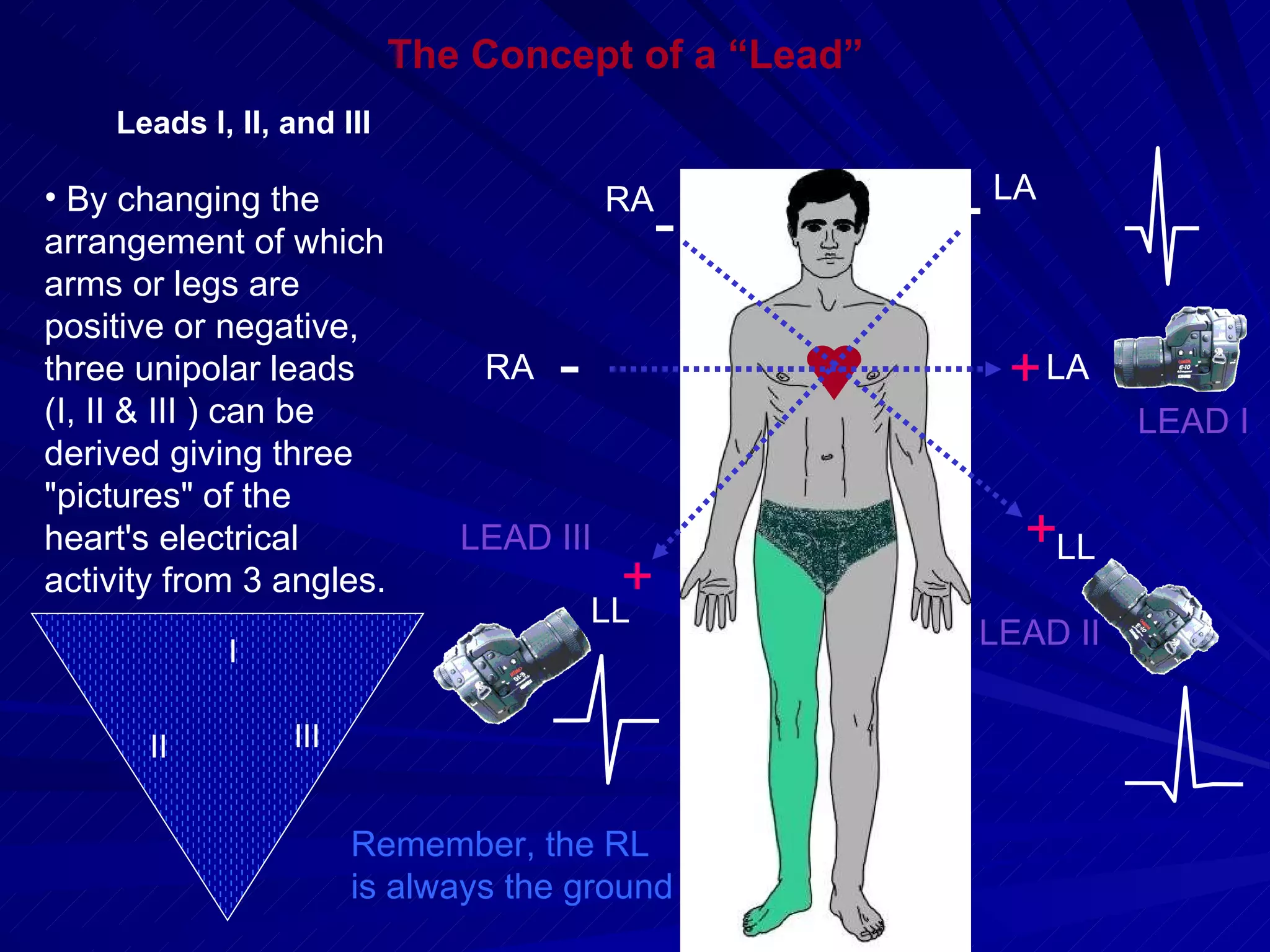 + - RA RA LL + + - - LA LL LA LEAD II LEAD I LEAD III Remember, the RL is always the ground By changing the arrangement of which arms or legs are positive or negative, three unipolar leads (I, II & III ) can be derived giving three &quot;pictures&quot; of the heart's electrical activity from 3 angles. The Concept of a “Lead” Leads I, II, and III I II III 