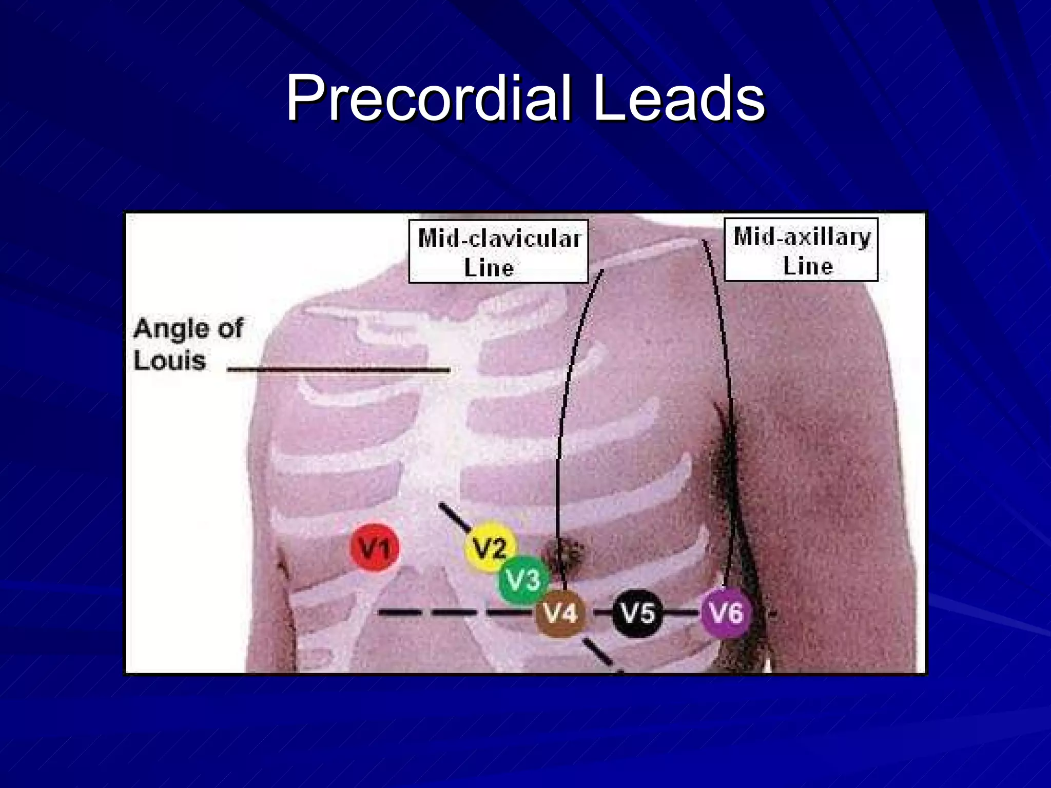 Precordial Leads 