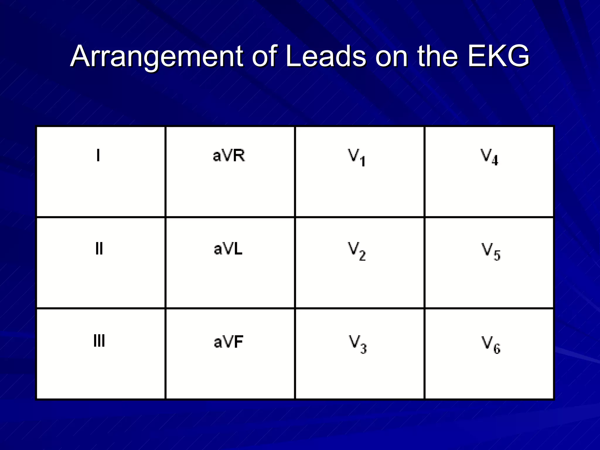 Arrangement of Leads on the EKG 