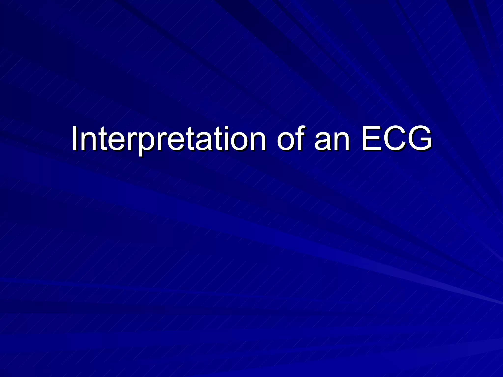 Interpretation of an ECG 