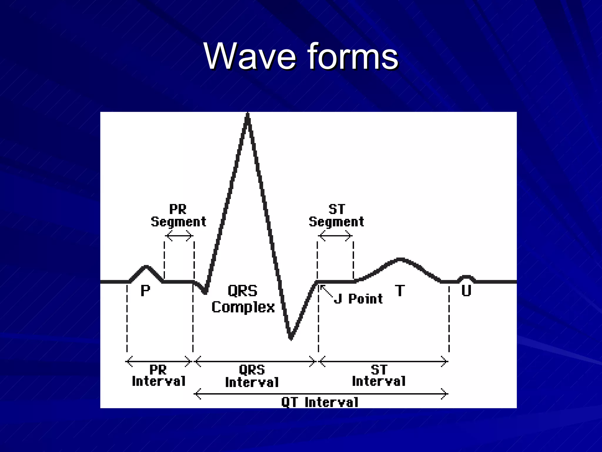 Wave forms 