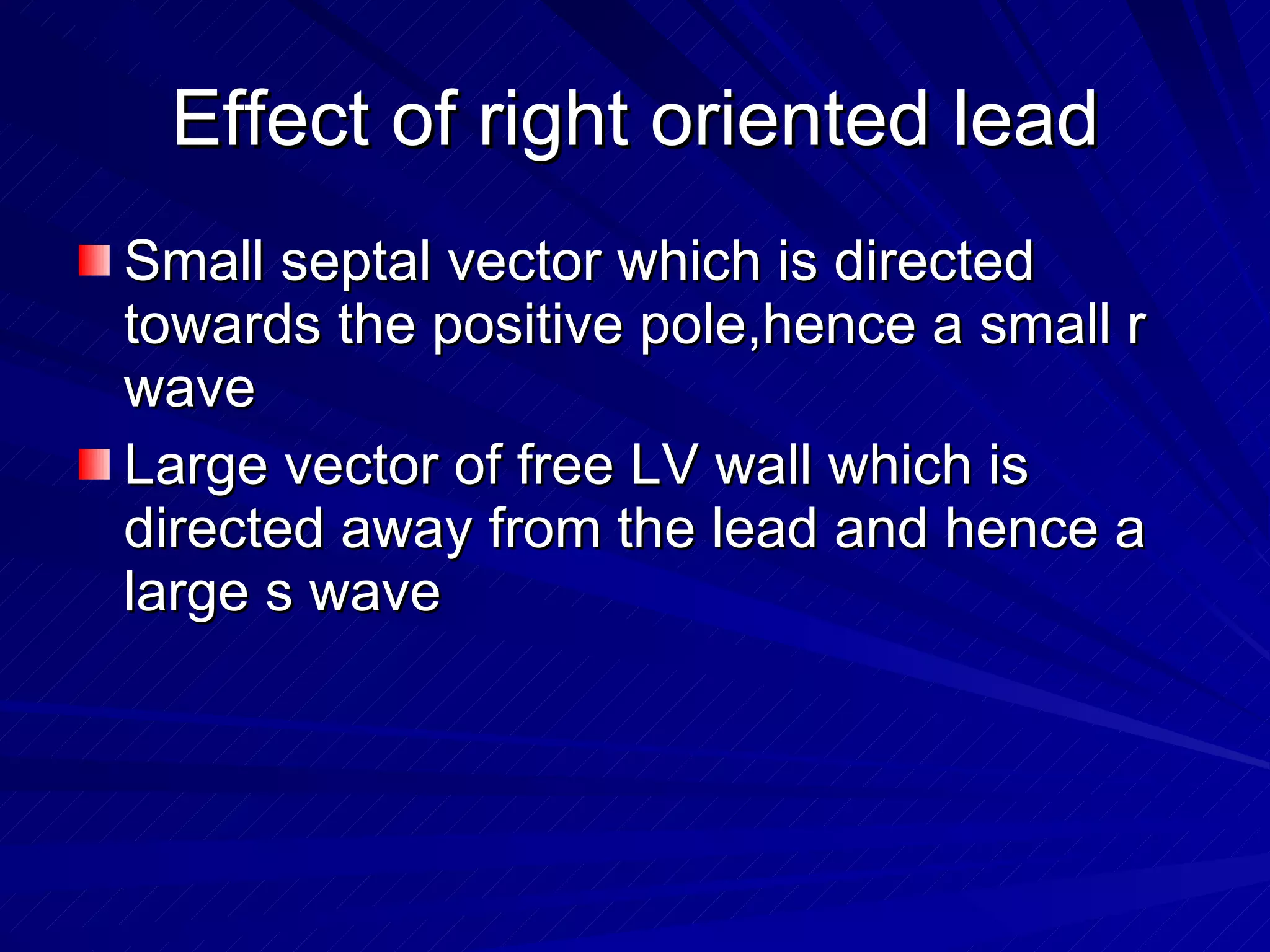 Effect of right oriented lead Small septal vector which is directed towards the positive pole,hence a small r wave Large vector of free LV wall which is directed away from the lead and hence a large s wave 