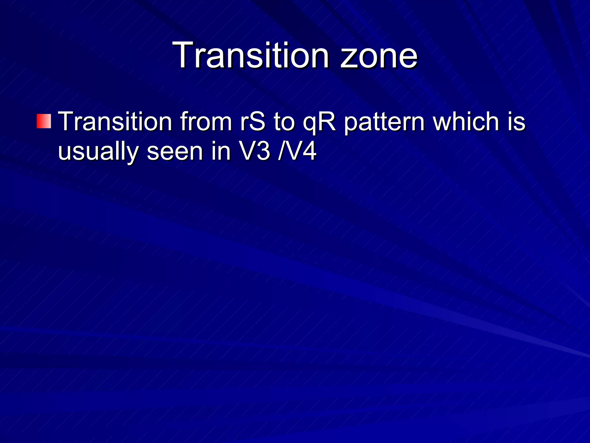 Transition zone Transition from rS to qR pattern which is usually seen in V3 /V4 