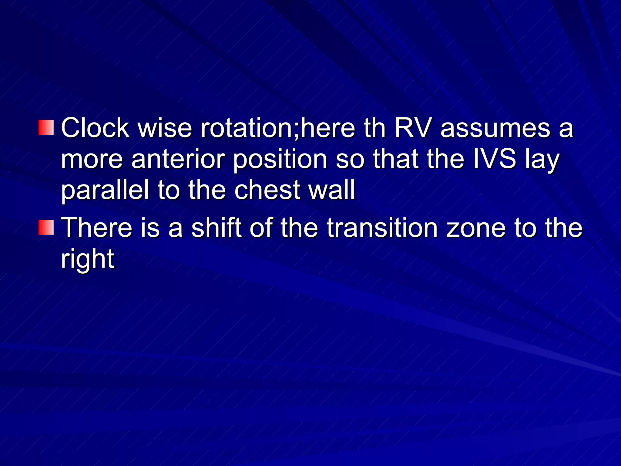Clock wise rotation;here th RV assumes a more anterior position so that the IVS lay parallel to the chest wall There is a shift of the transition zone to the right 