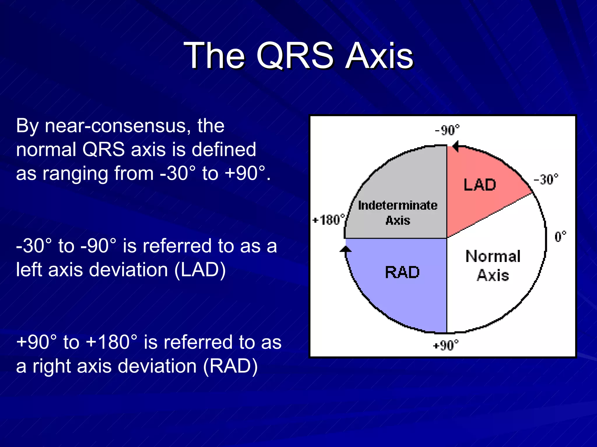 The QRS Axis By near-consensus, the normal QRS axis is defined as ranging from -30 °  to +90 ° . -30 °  to -90 °  is referred to as a left axis deviation (LAD) +90 °  to +180 °  is referred to as a right axis deviation (RAD) 