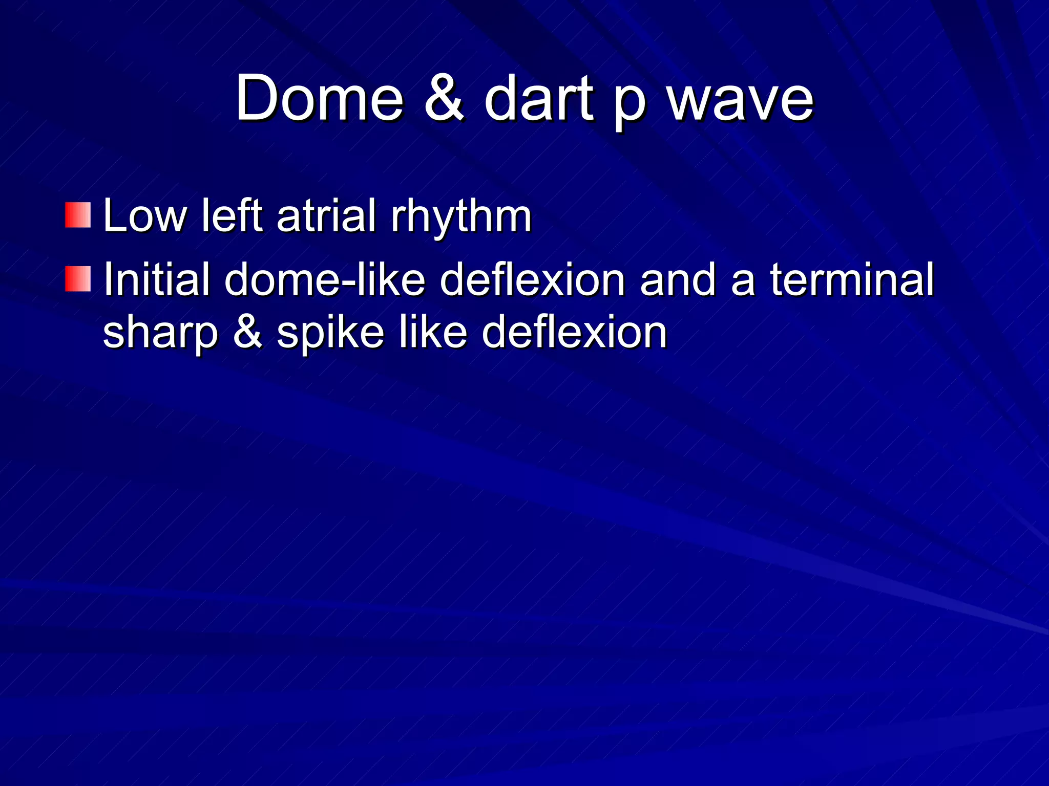 Dome & dart p wave Low left atrial rhythm Initial dome-like deflexion and a terminal sharp & spike like deflexion 