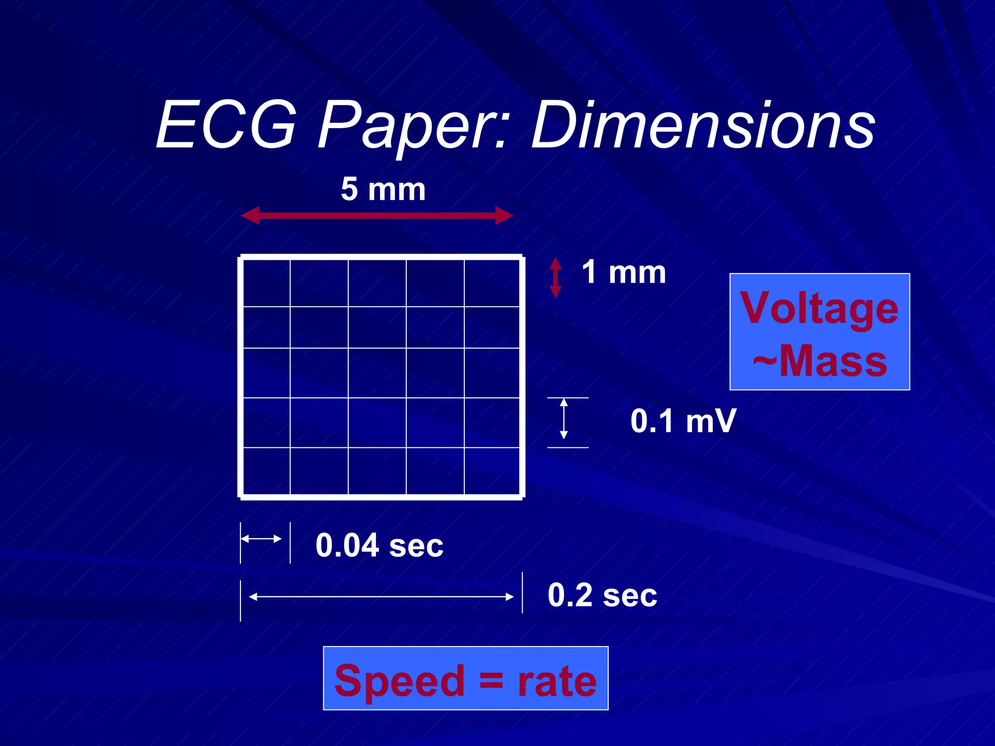 ECG Paper: Dimensions 5 mm 1 mm 0.1 mV 0.04 sec 0.2 sec Speed = rate Voltage ~Mass 