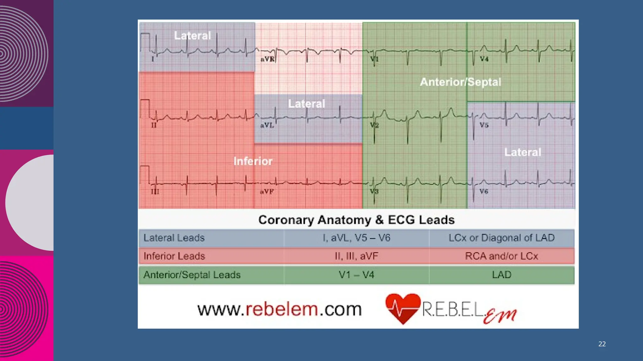 Basics of Electro Cardio Gram Interpretation.pptx