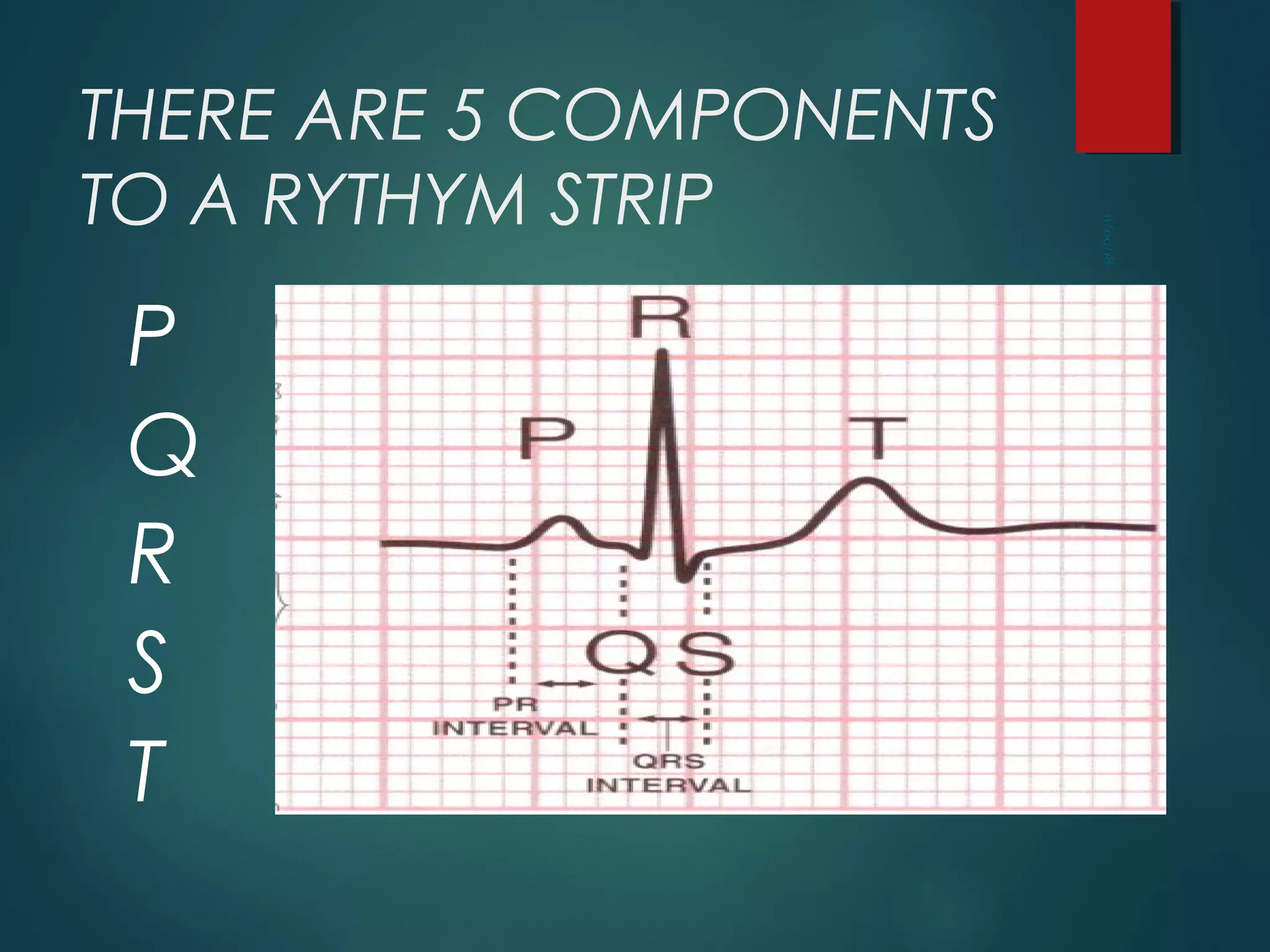 THERE ARE 5 COMPONENTS
TO A RYTHYM STRIP
P
Q
R
S
T
11/09/18
 