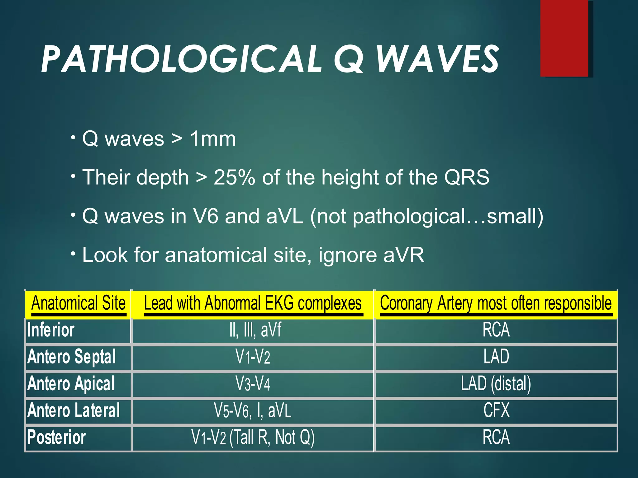 PATHOLOGICAL Q WAVES
• Q waves > 1mm
• Their depth > 25% of the height of the QRS
• Q waves in V6 and aVL (not pathological…small)
• Look for anatomical site, ignore aVR
Anatomical Site Lead with Abnormal EKG complexes Coronary Artery most often responsible
Inferior II, III, aVf RCA
Antero Septal V1-V2 LAD
Antero Apical V3-V4 LAD (distal)
Antero Lateral V5-V6, I, aVL CFX
Posterior V1-V2 (Tall R, Not Q) RCA
 