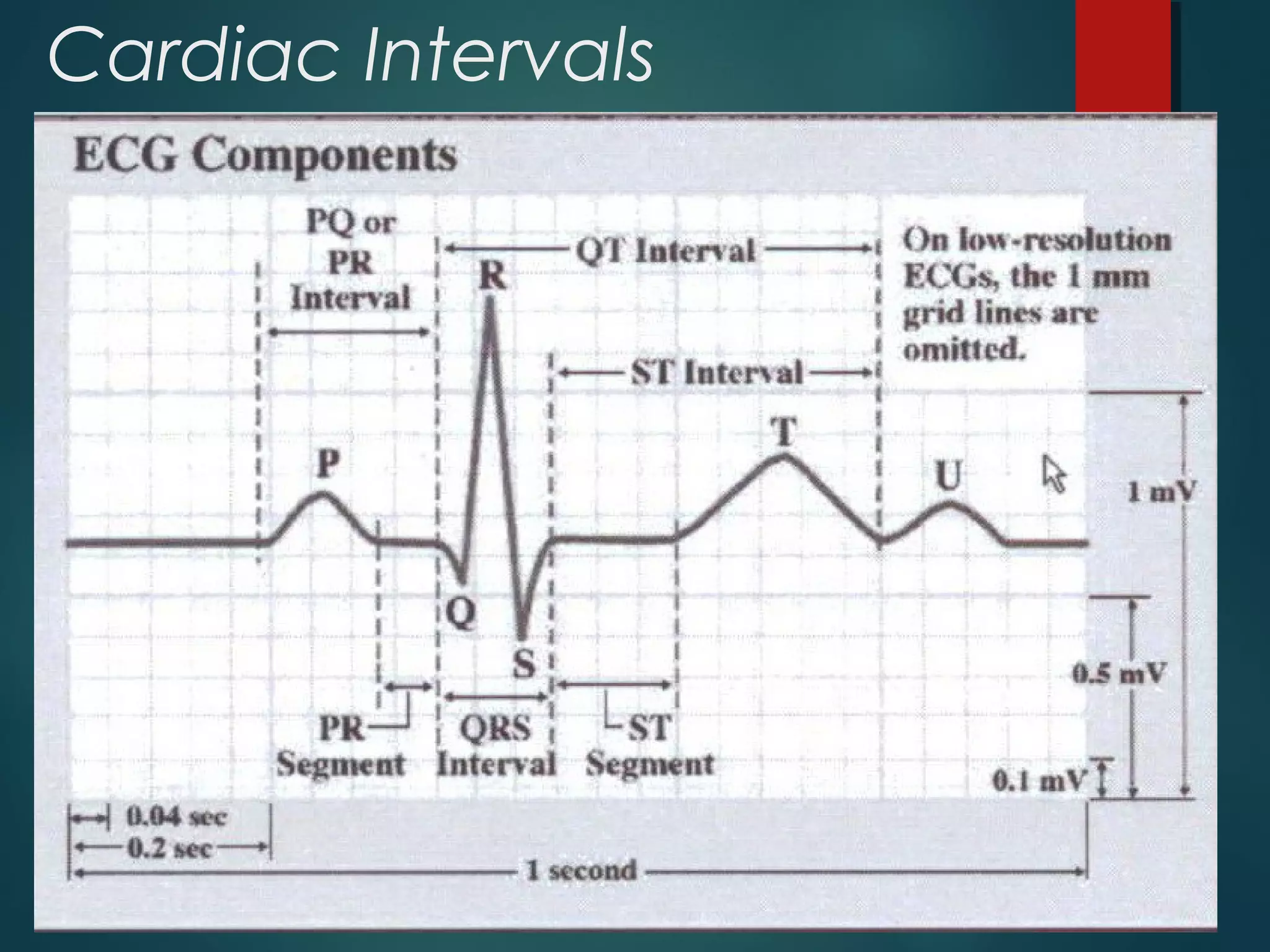 Cardiac Intervals
11/09/18
19
 