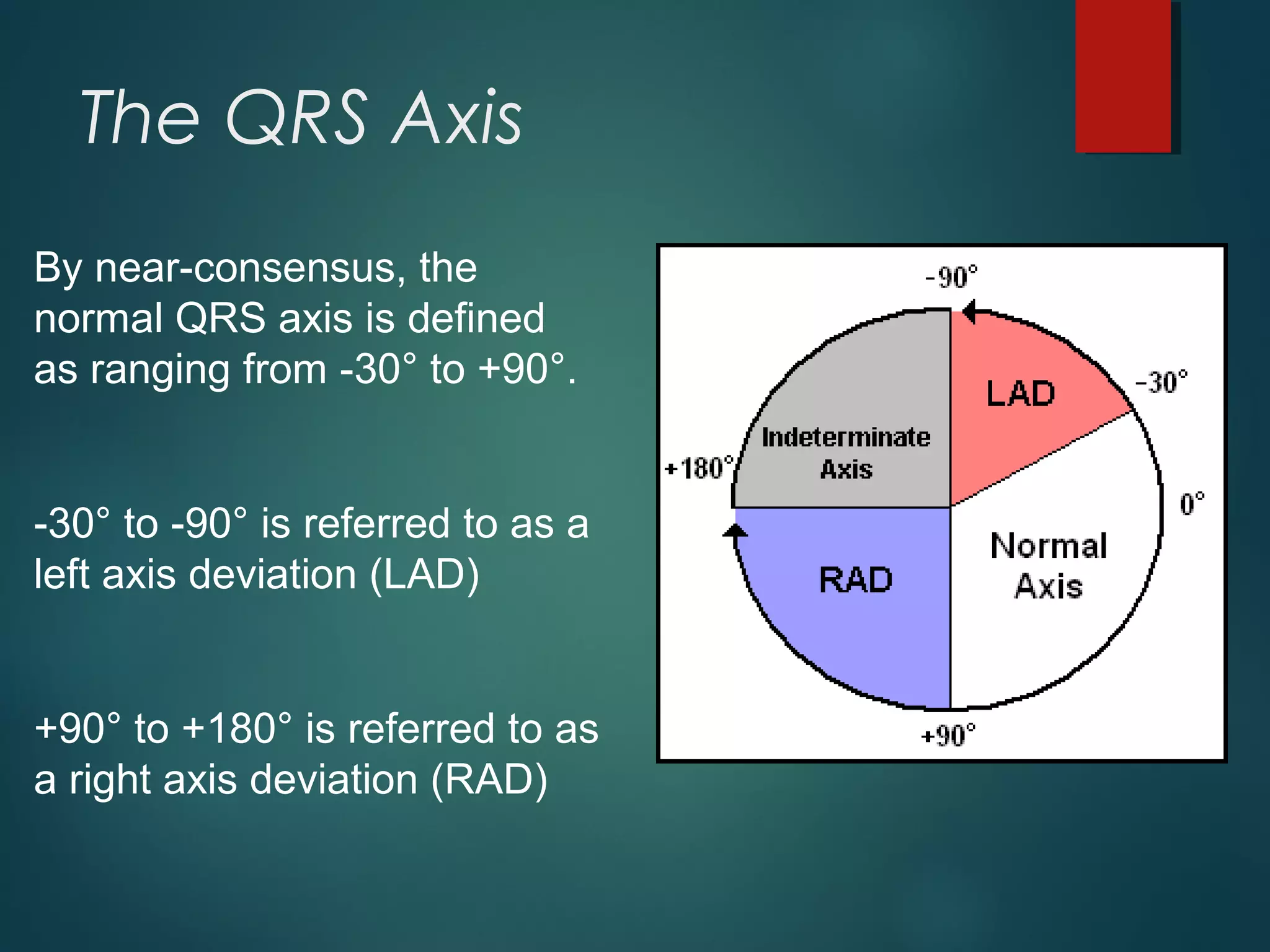 The QRS Axis
By near-consensus, the
normal QRS axis is defined
as ranging from -30° to +90°.
-30° to -90° is referred to as a
left axis deviation (LAD)
+90° to +180° is referred to as
a right axis deviation (RAD)
 