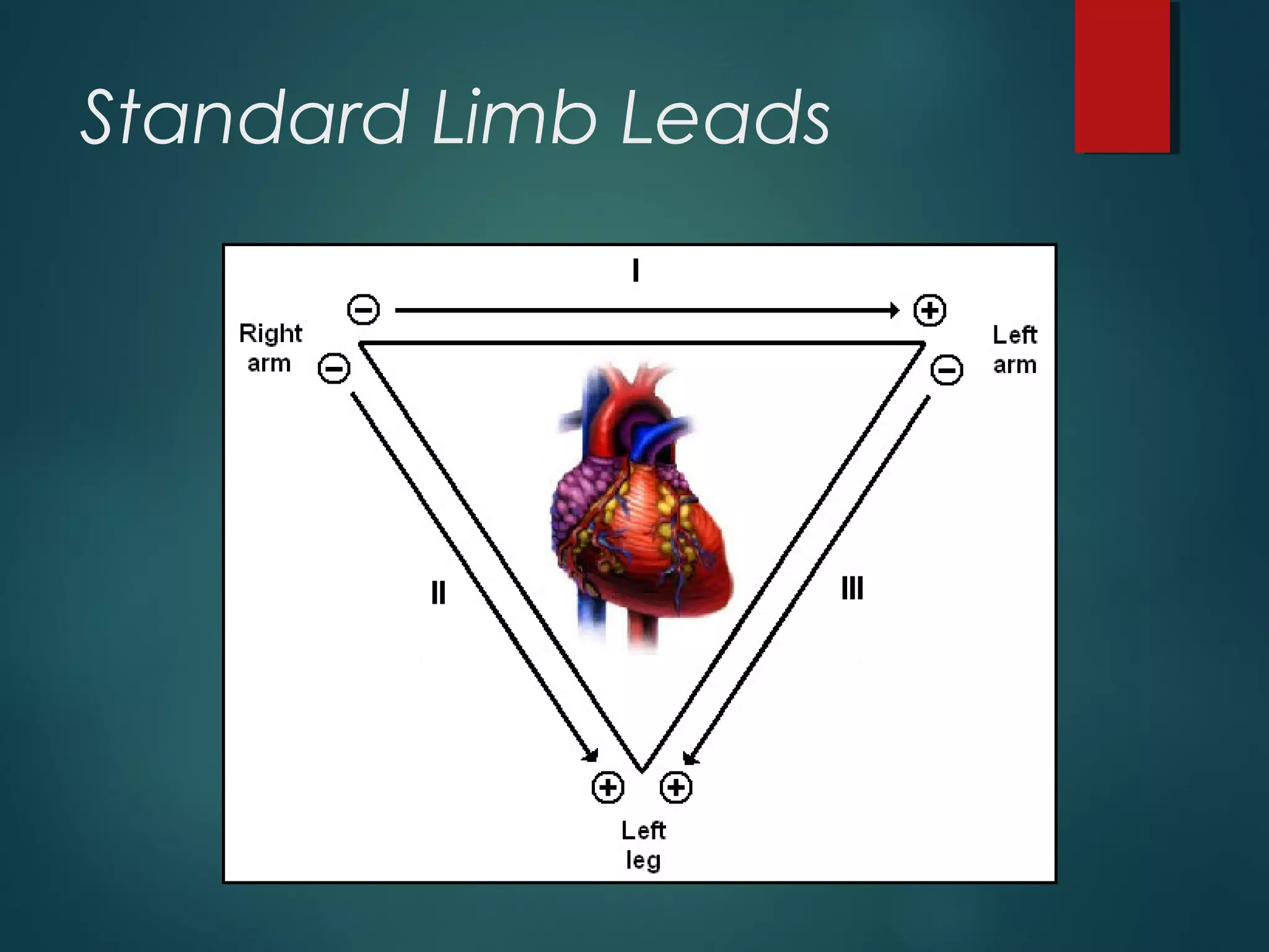 Standard Limb Leads
 