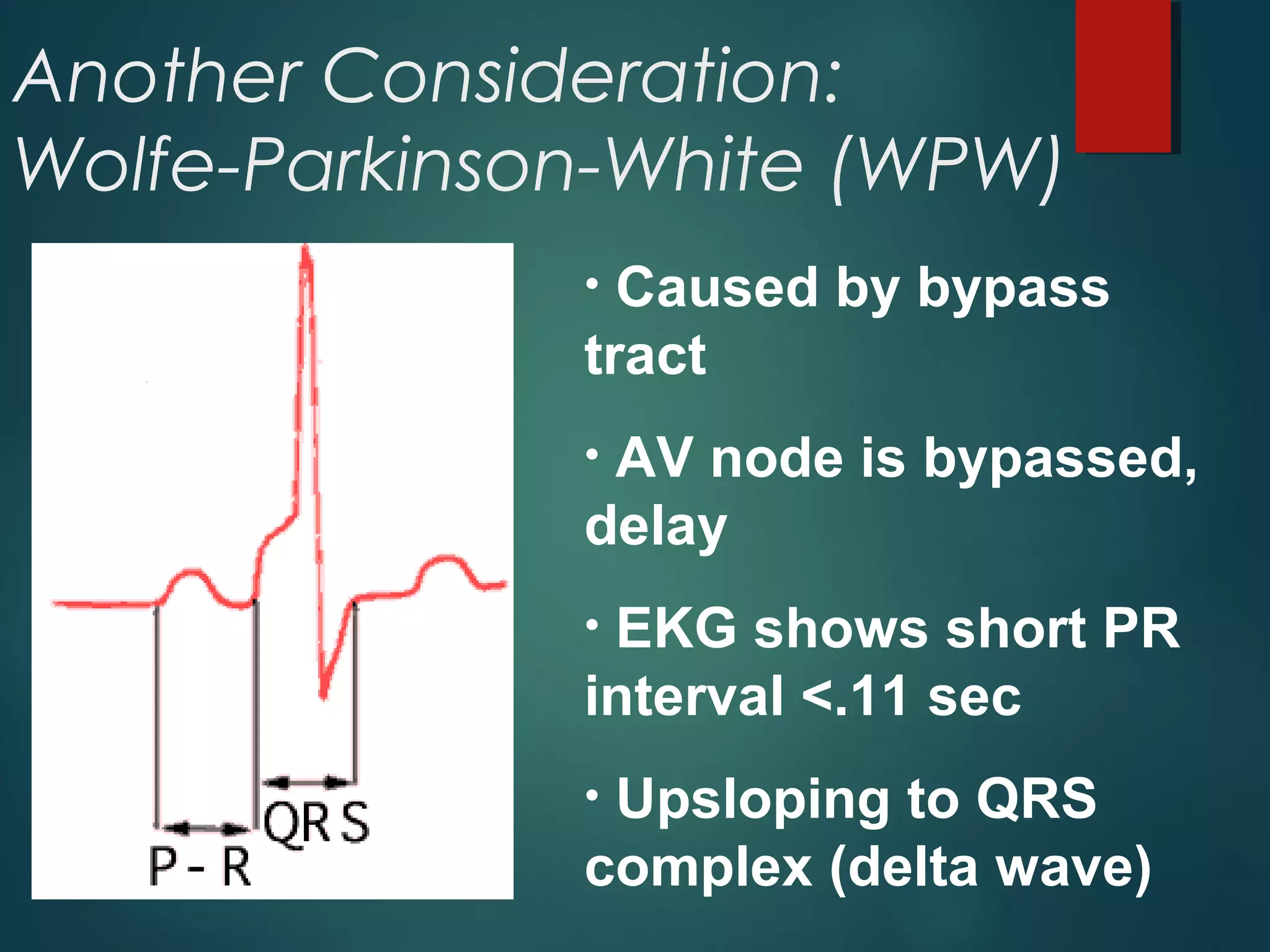 Another Consideration:
Wolfe-Parkinson-White (WPW)
• Caused by bypass
tract
• AV node is bypassed,
delay
• EKG shows short PR
interval <.11 sec
• Upsloping to QRS
complex (delta wave)
 
