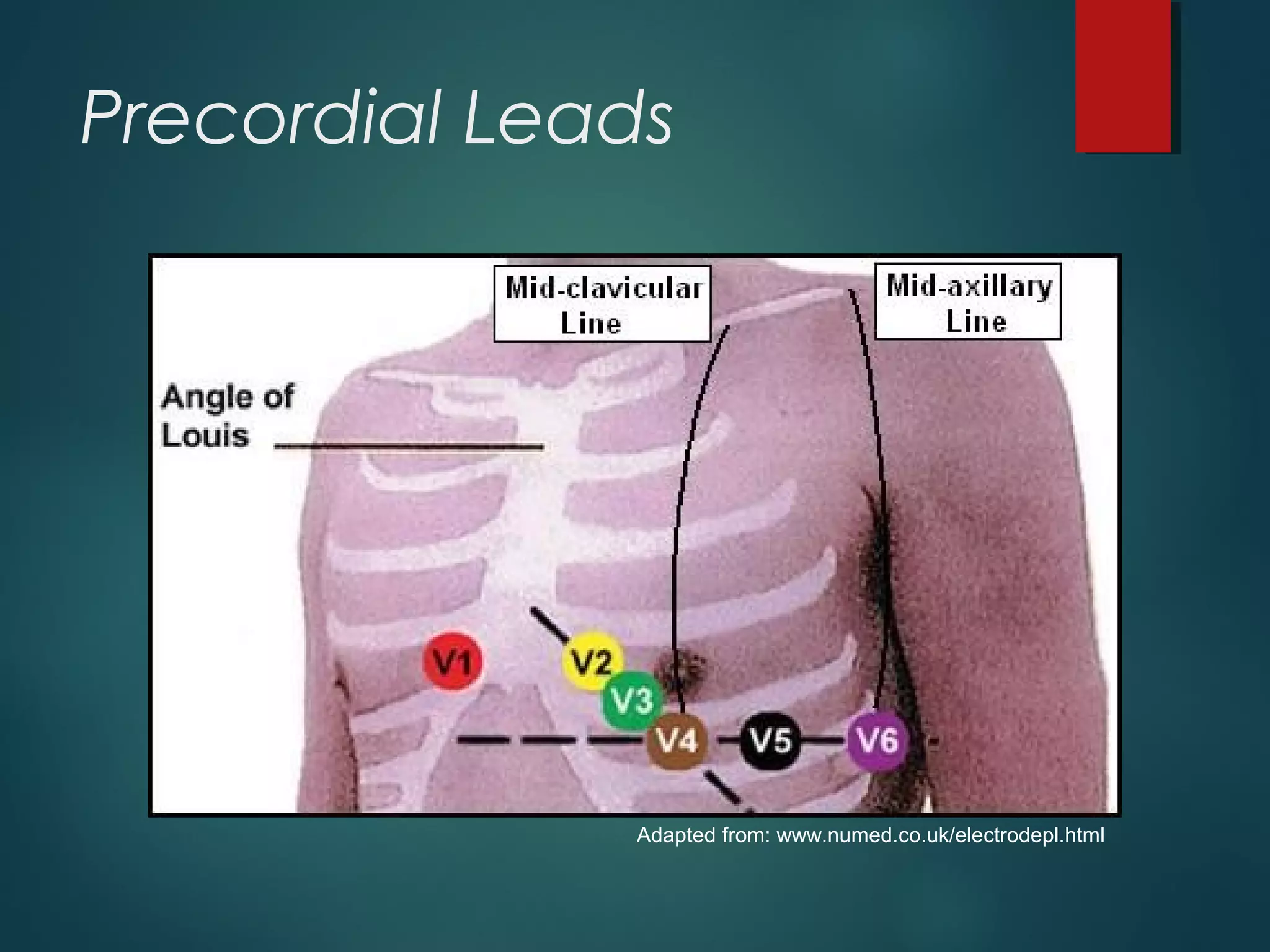 Precordial Leads
Adapted from: www.numed.co.uk/electrodepl.html
 