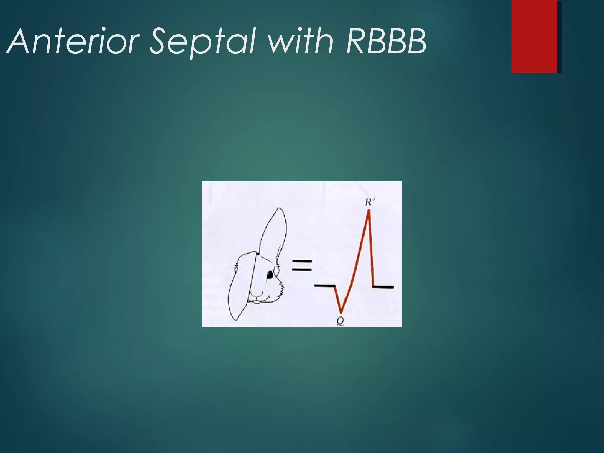 Anterior Septal with RBBB
 
