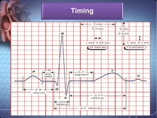 Basics of ECG physiology | PDF