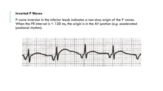 BASICS OF ELECTROCARDIOGRAPHY: A COMPREHENSIVE GUIDE | PDF