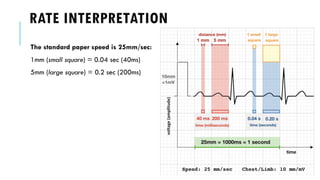 BASICS OF ELECTROCARDIOGRAPHY: A COMPREHENSIVE GUIDE | PDF