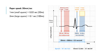 BASICS OF ELECTROCARDIOGRAPHY: A COMPREHENSIVE GUIDE | PDF
