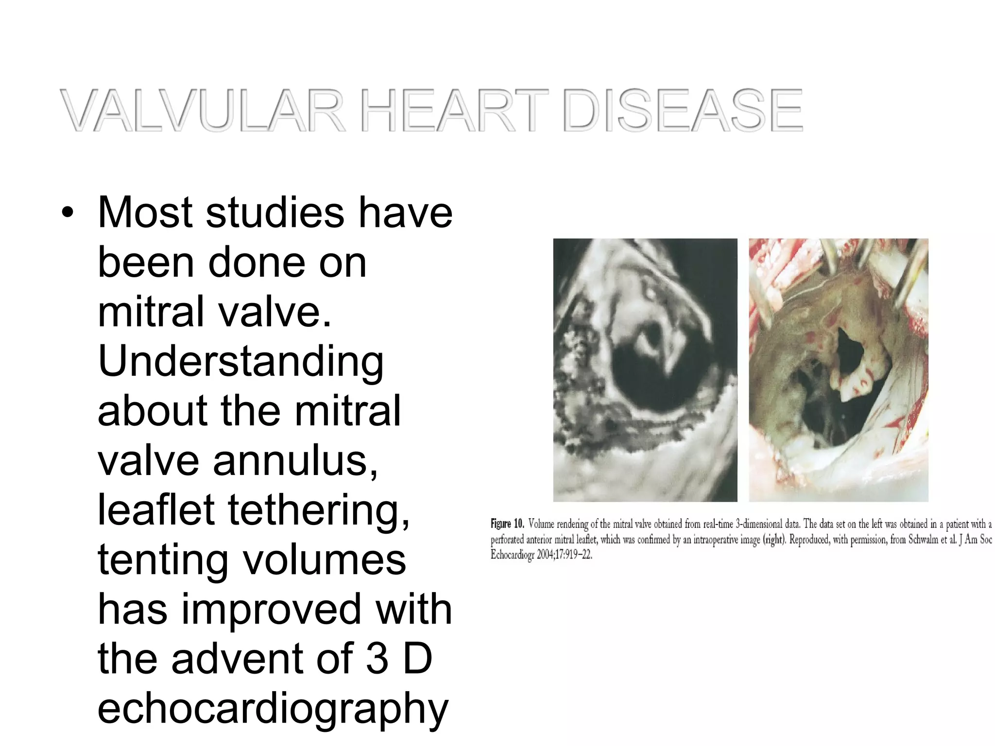 • Most studies have
been done on
mitral valve.
Understanding
about the mitral
valve annulus,
leaflet tethering,
tenting volumes
has improved with
the advent of 3 D
echocardiography
 