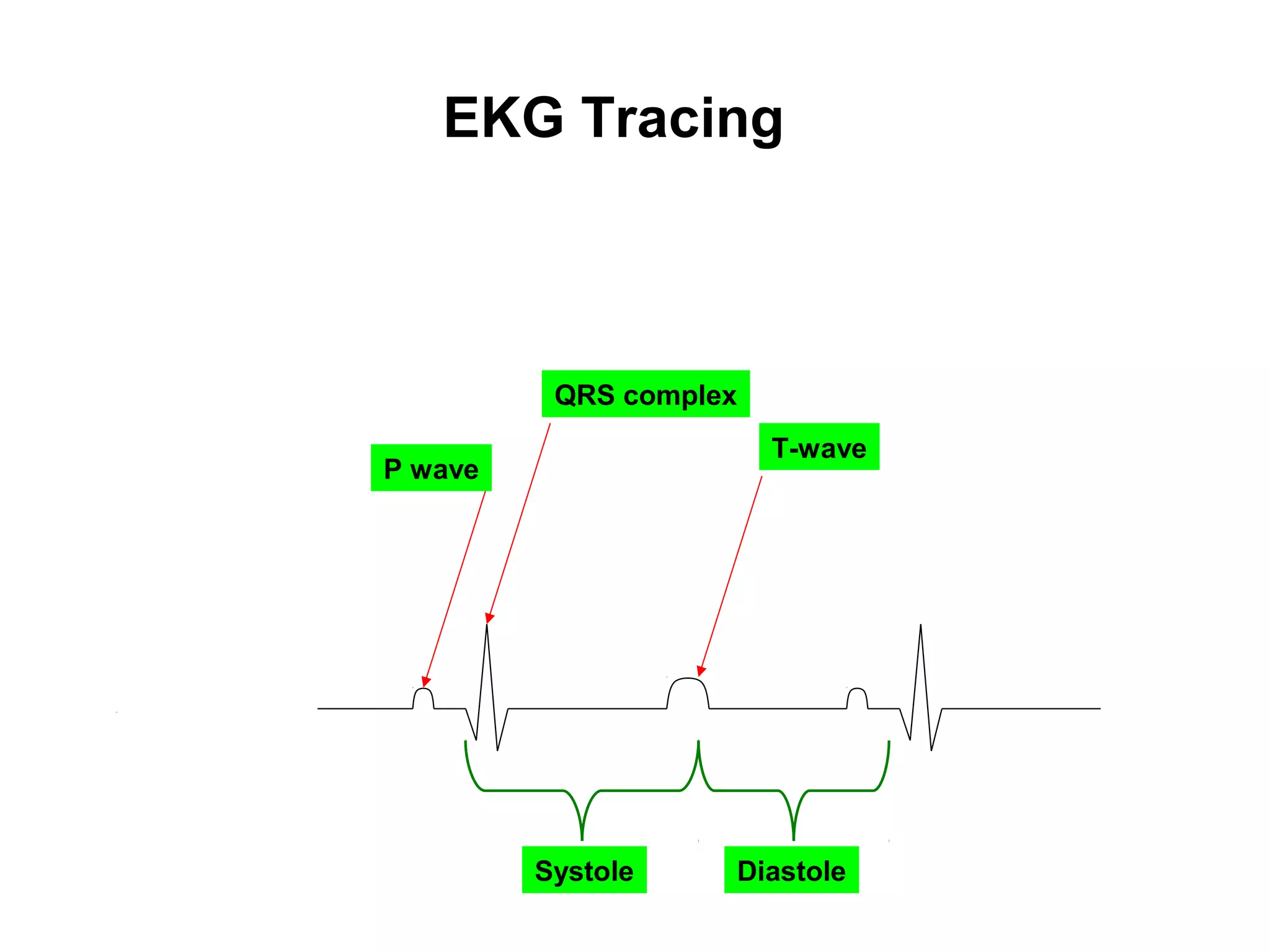 EKG Tracing
T-wave
QRS complex
P wave
Systole Diastole
 