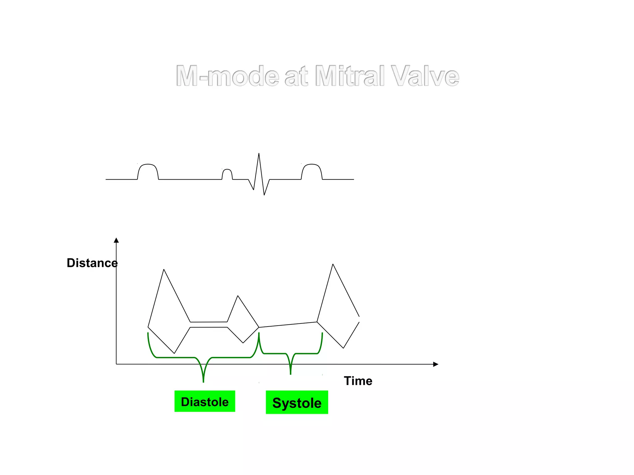 Distance
SystoleDiastole
Time
 