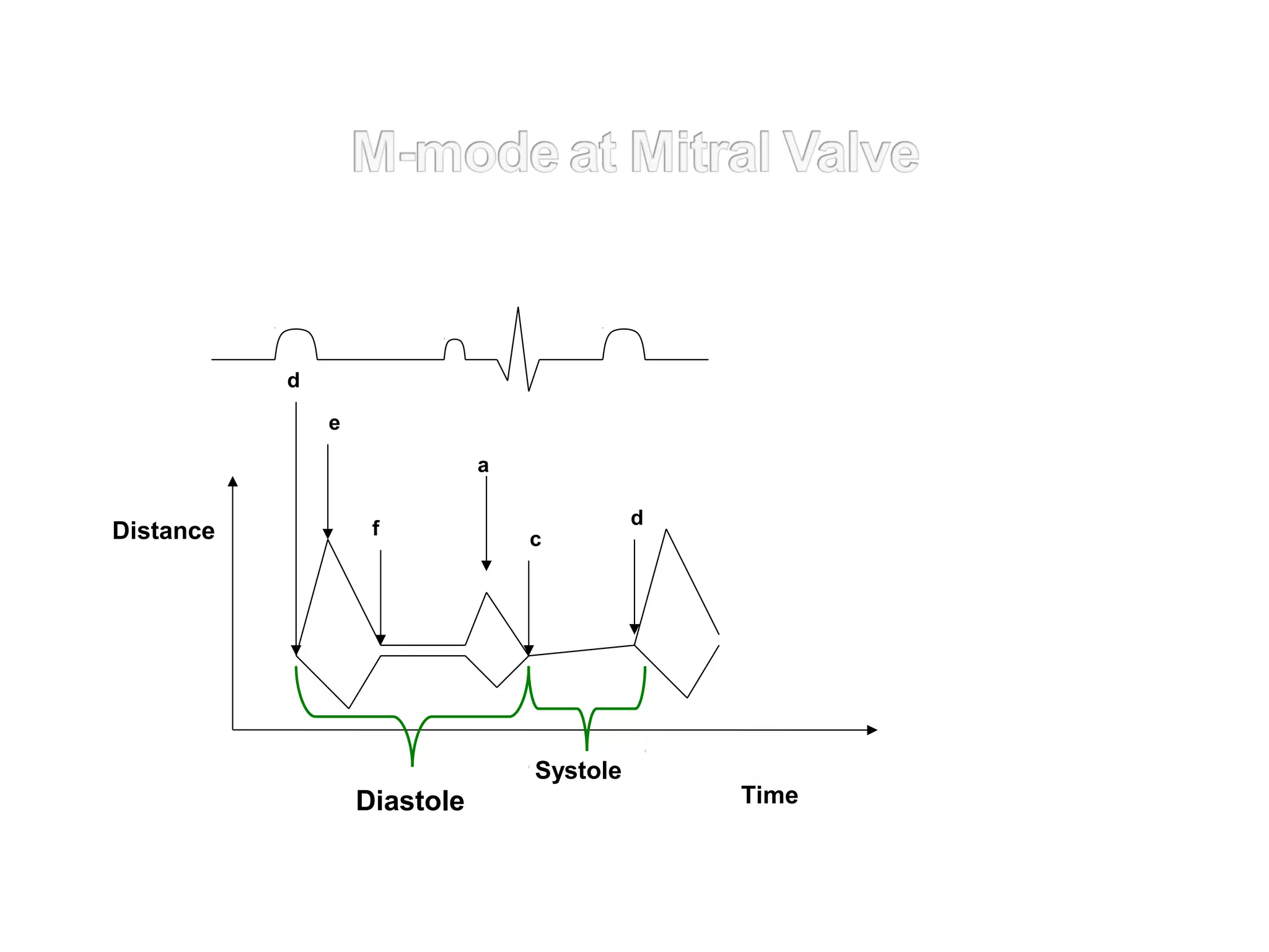 Systole
Diastole
d
c
a
f
e
d
Time
Distance
 