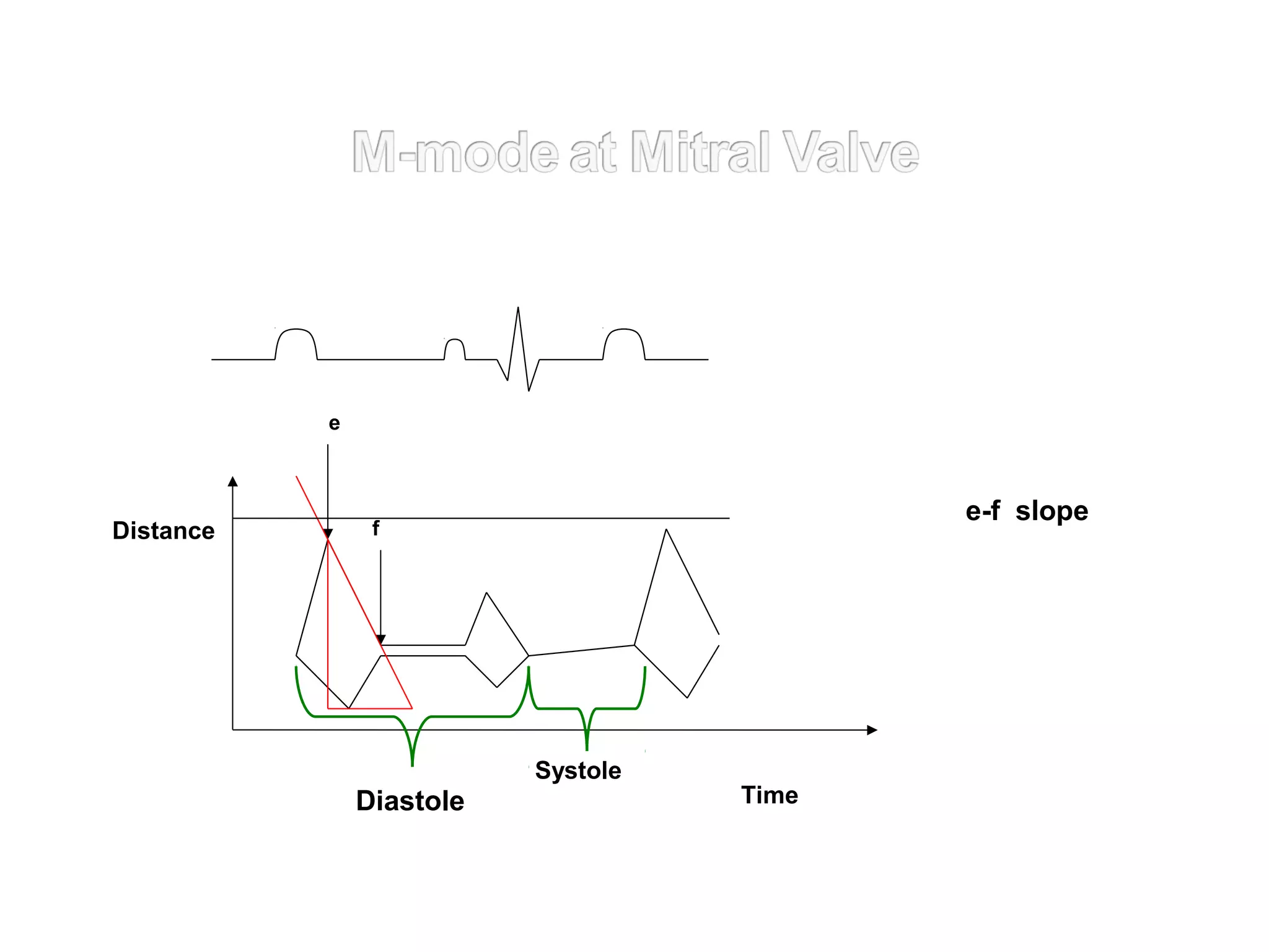 Systole
Diastole
f
e
Time
Distance
e-f slope
 