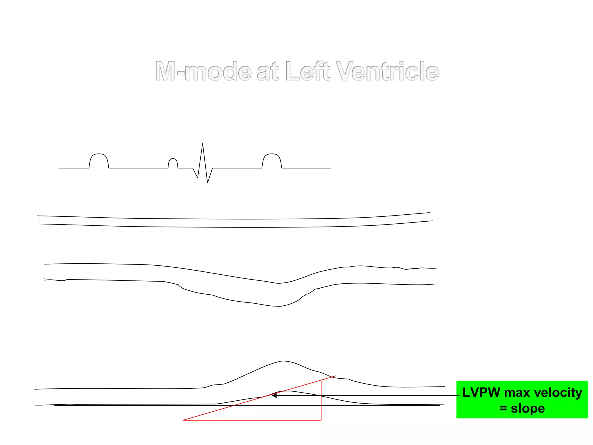 LVPW max velocity
= slope
 