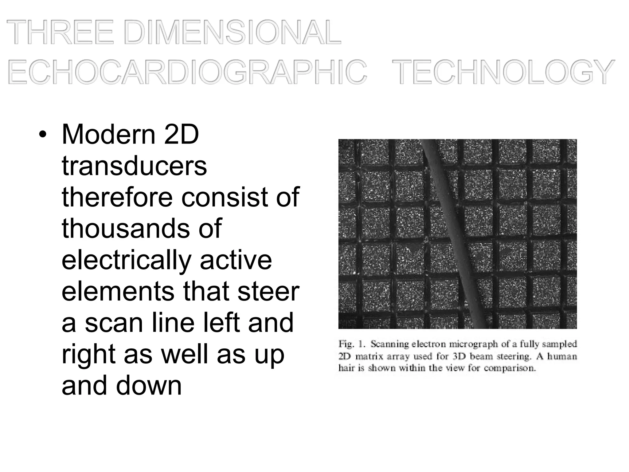 • Modern 2D
transducers
therefore consist of
thousands of
electrically active
elements that steer
a scan line left and
right as well as up
and down
 