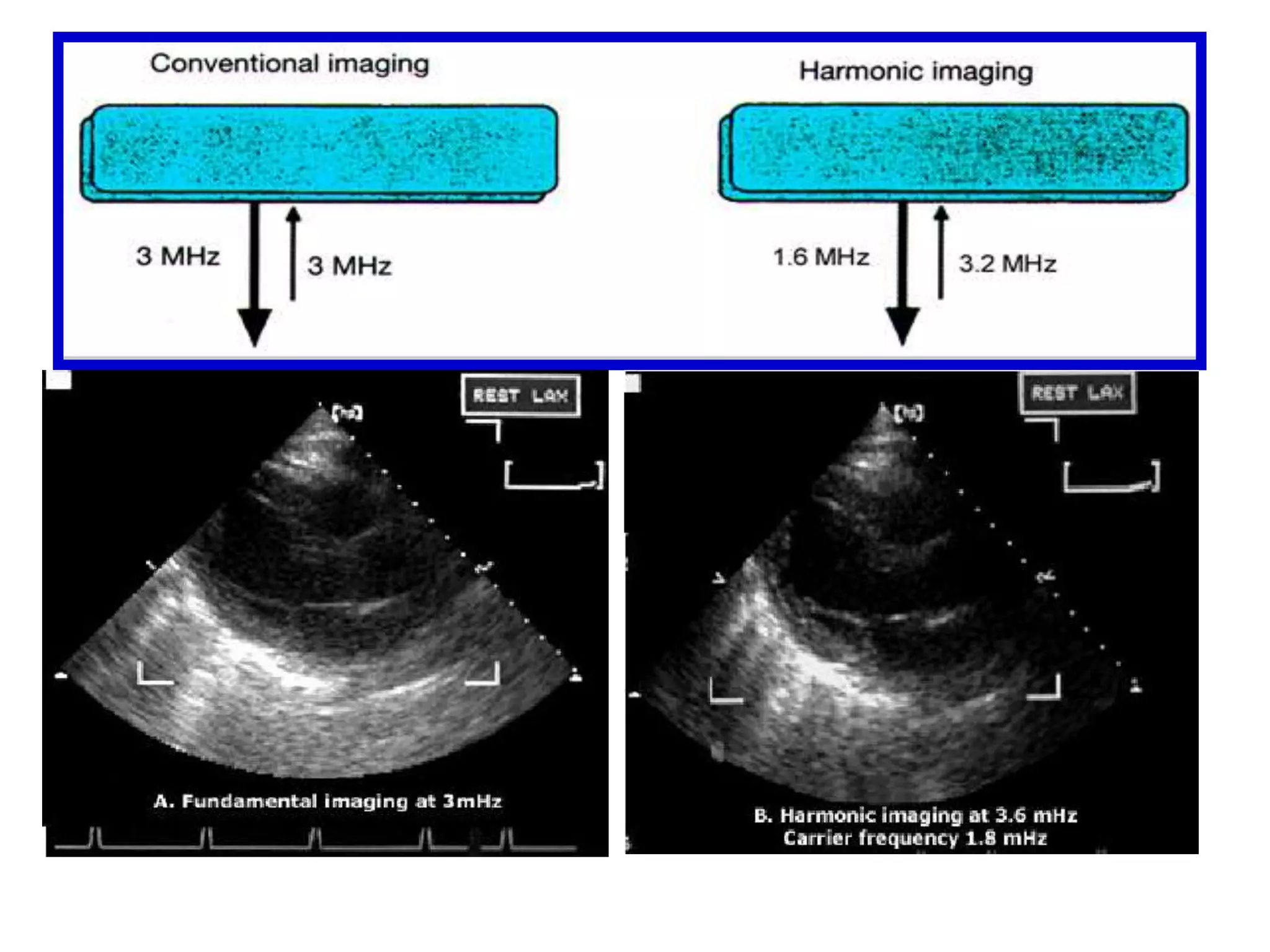 12 cm for 2.5 MHz transducer, and 