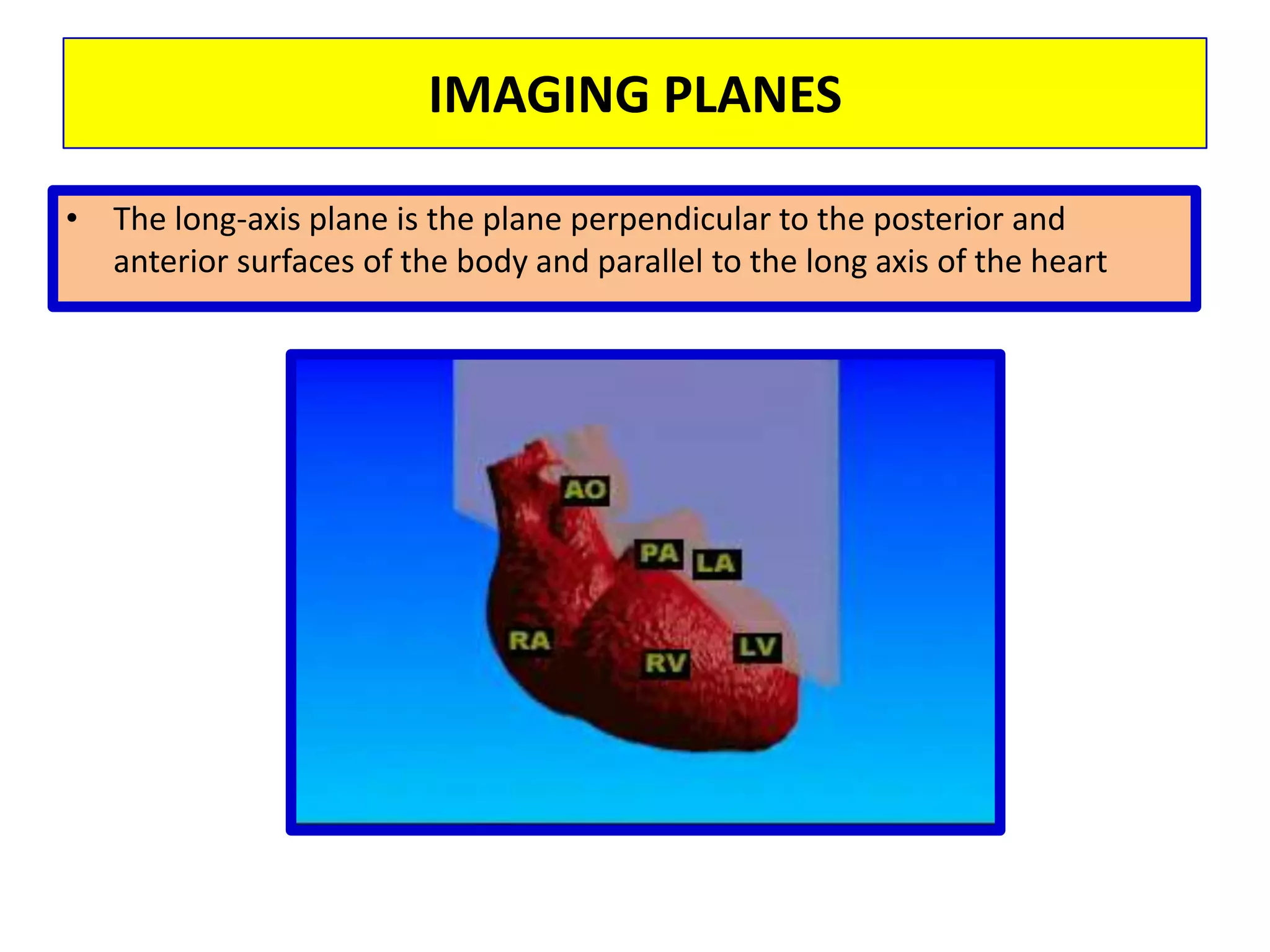 SECOND HARMONIC IMAGING(improving resolution)An ultrasound wave traveling through tissue becomes distorted, which generates additional sound frequencies that are harmonics of the original or fundamental frequencyproduces more harmonics the further it travels through tissue