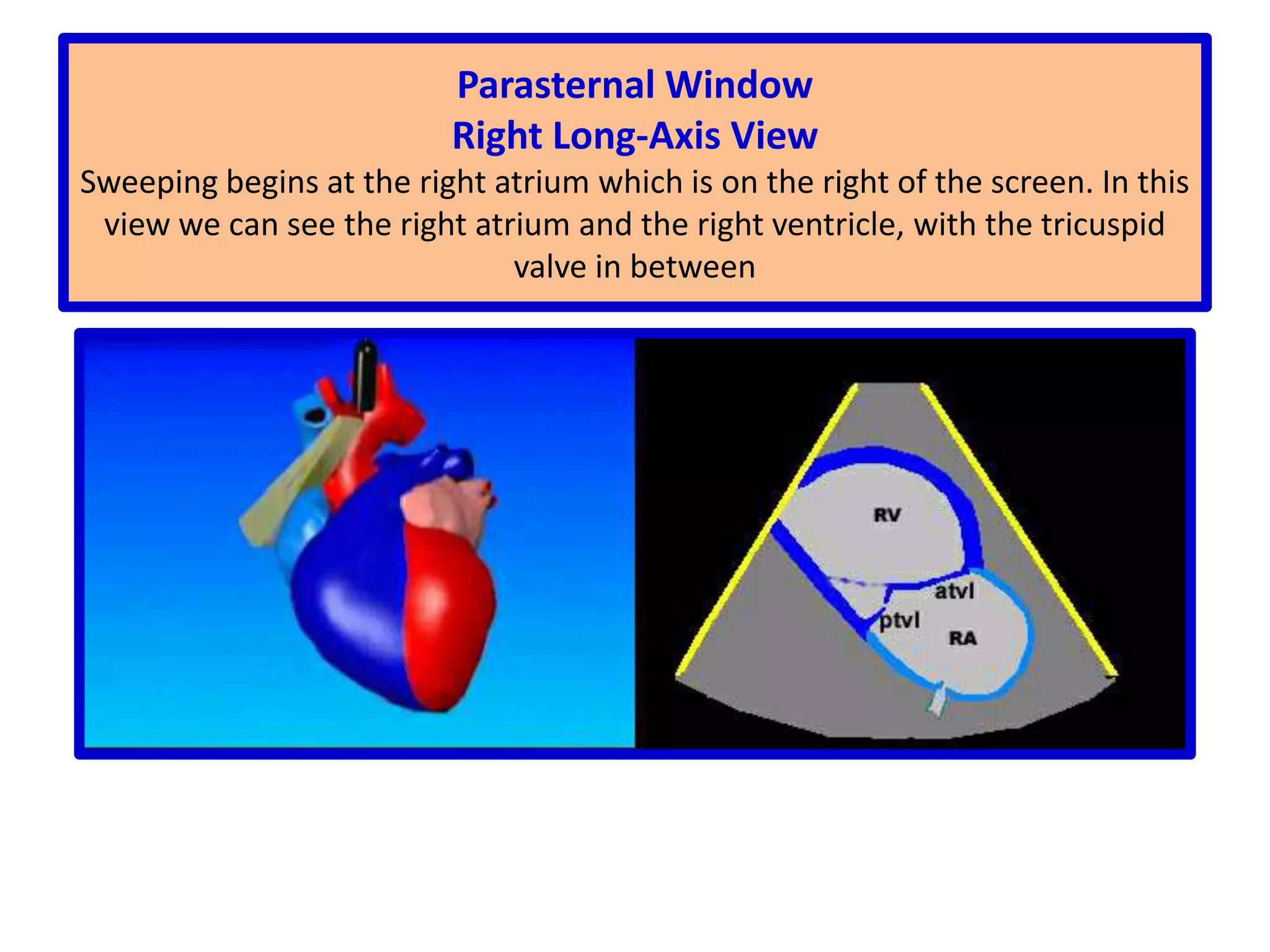 A.  2-D  ECHOCARDIOGRAPHY