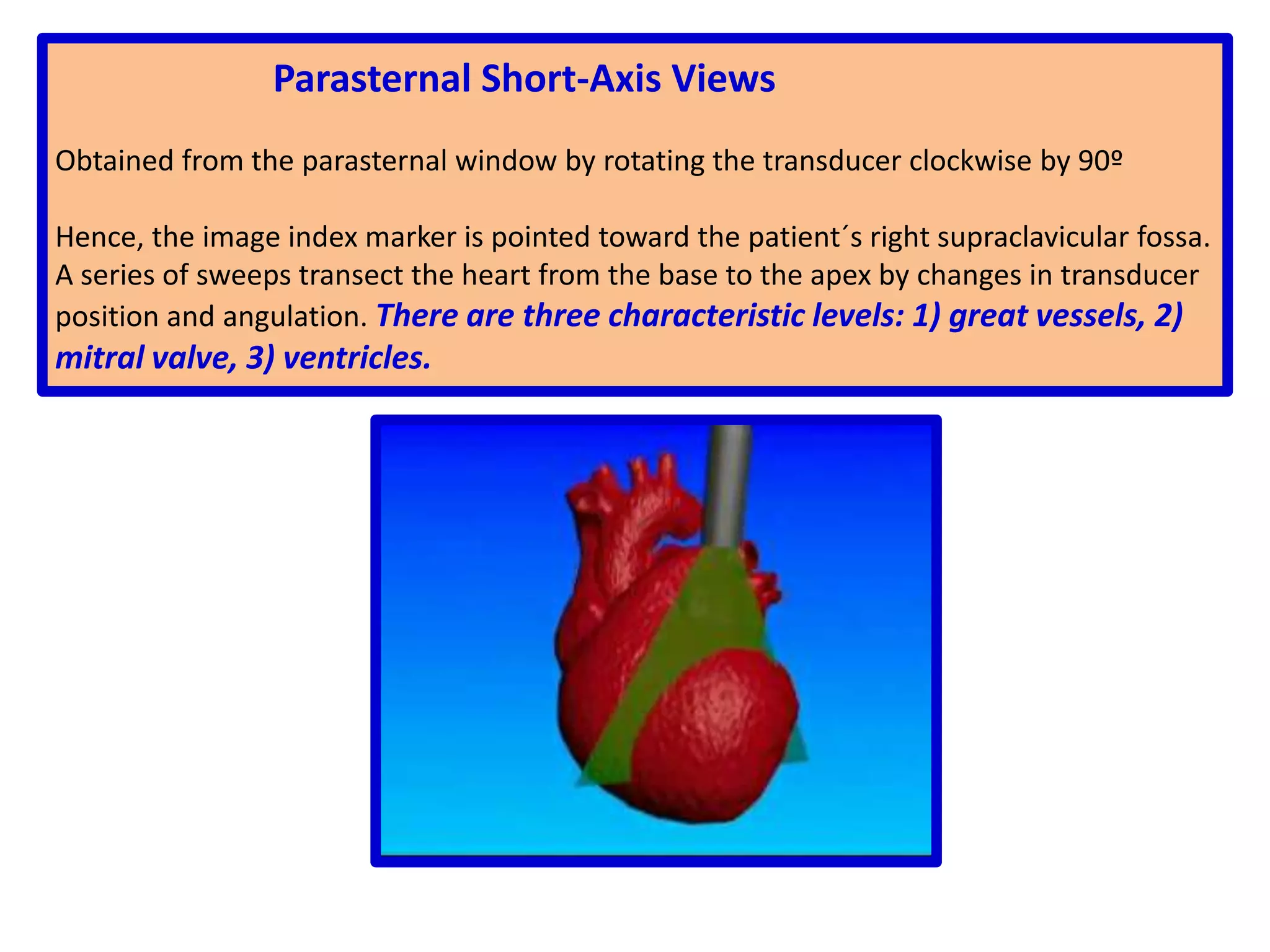 The smallest depth that permits display of the region of interest should be employedFOCUS:Indicates the region of the image in which the ultrasound beam is narrowest