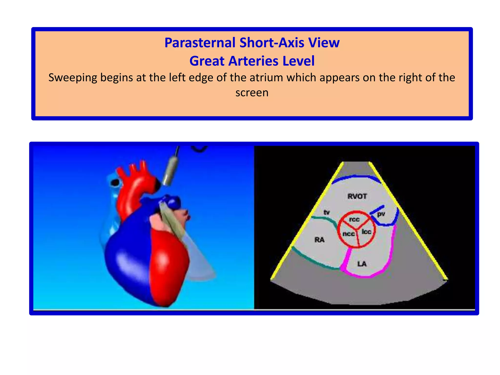 Resolution is greatest in this regionGAIN:This function adjusts the displayed amplitude of all received signalsTRANSTHORACIC ACOUSTIC WINDOWS