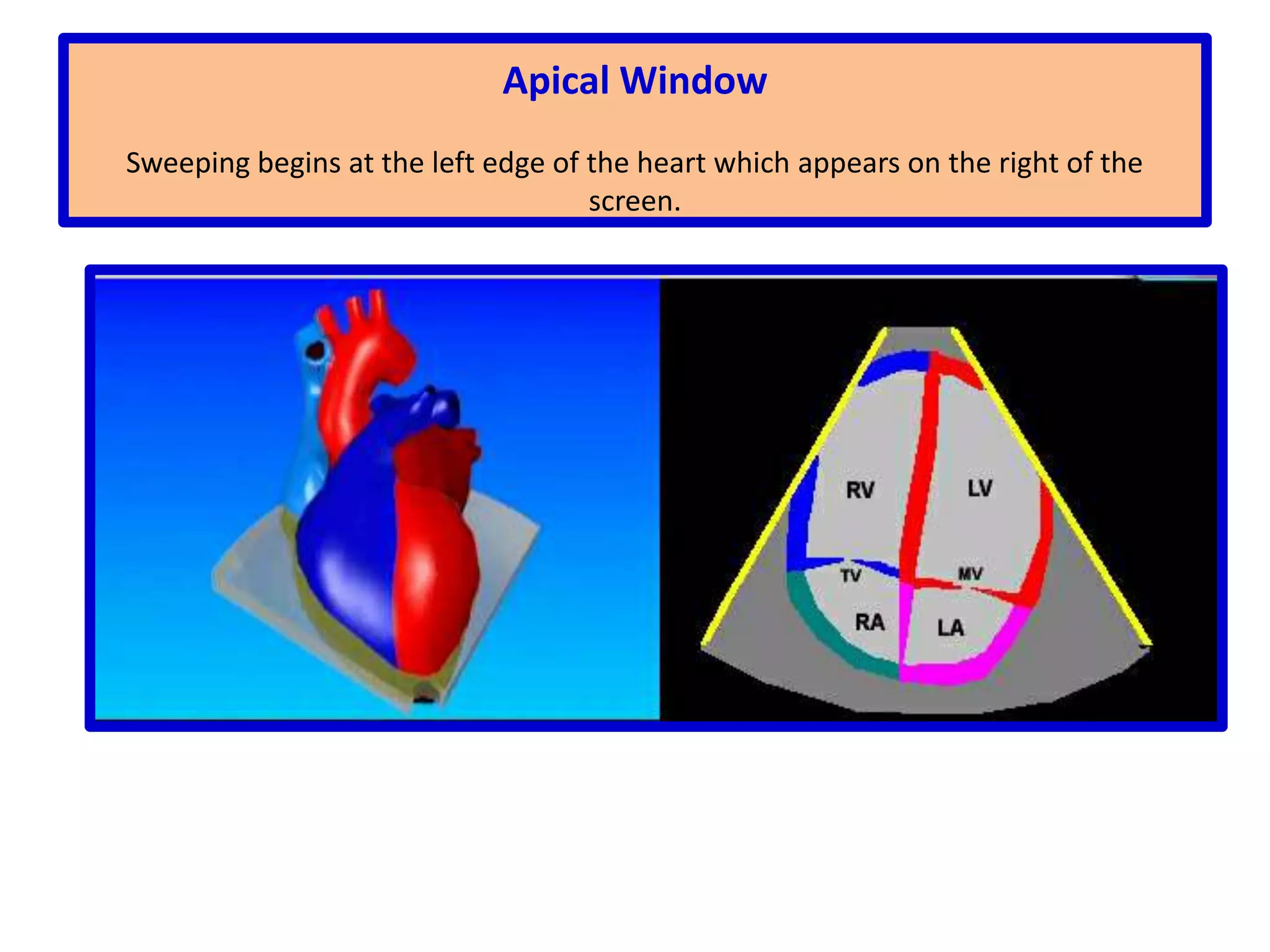 The short-axis plane is the plane that runs parallel to the posterior and anterior surfaces of the body and transects the heart from its apex to its base encompassing all four cardiac chambers