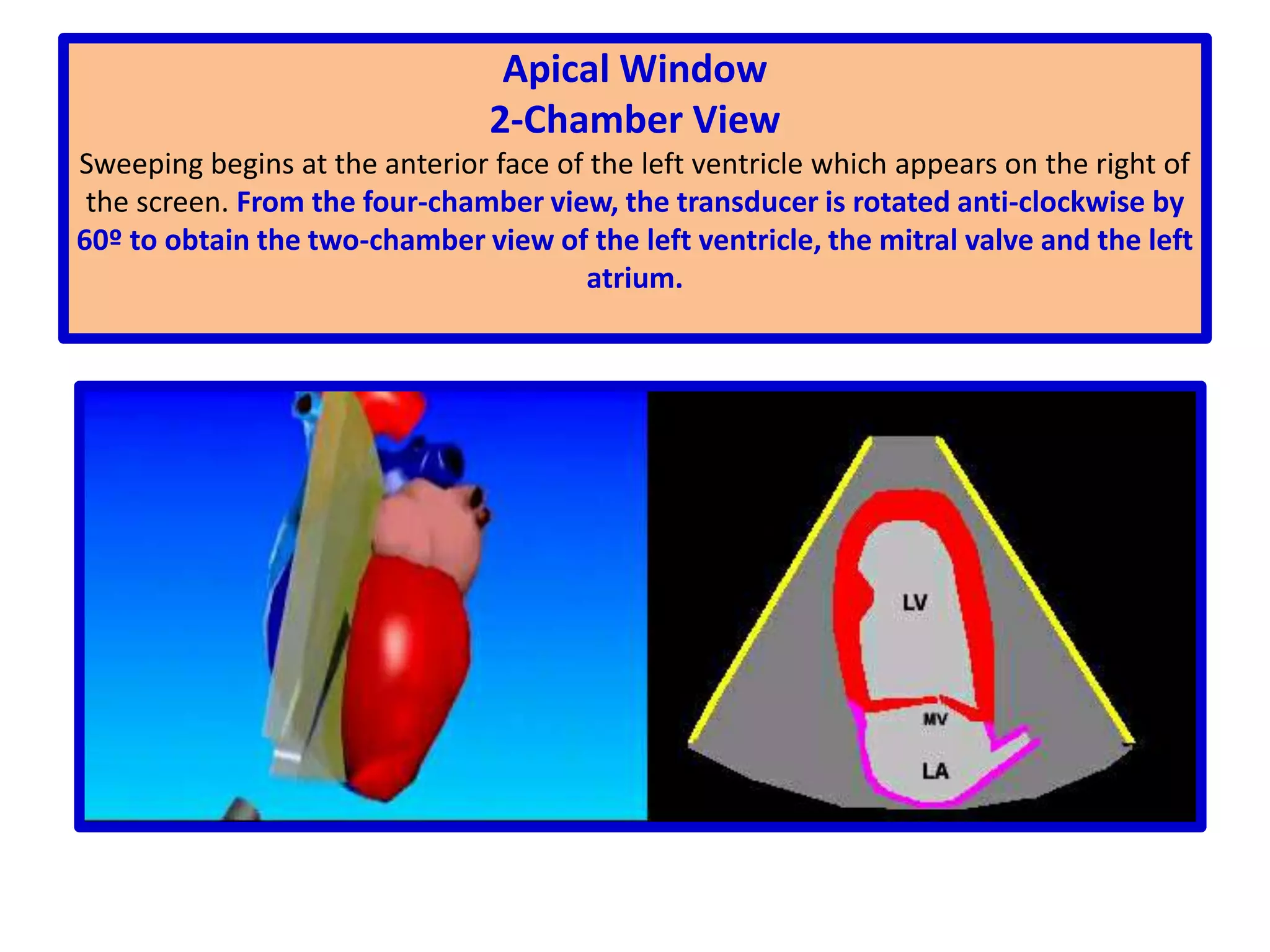 At aortic valve level it demonstrates all three aortic valve leaflets. The pulmonary valve, the right ventricular outflow tract, the right atrium and the left atrium are seen in this view.